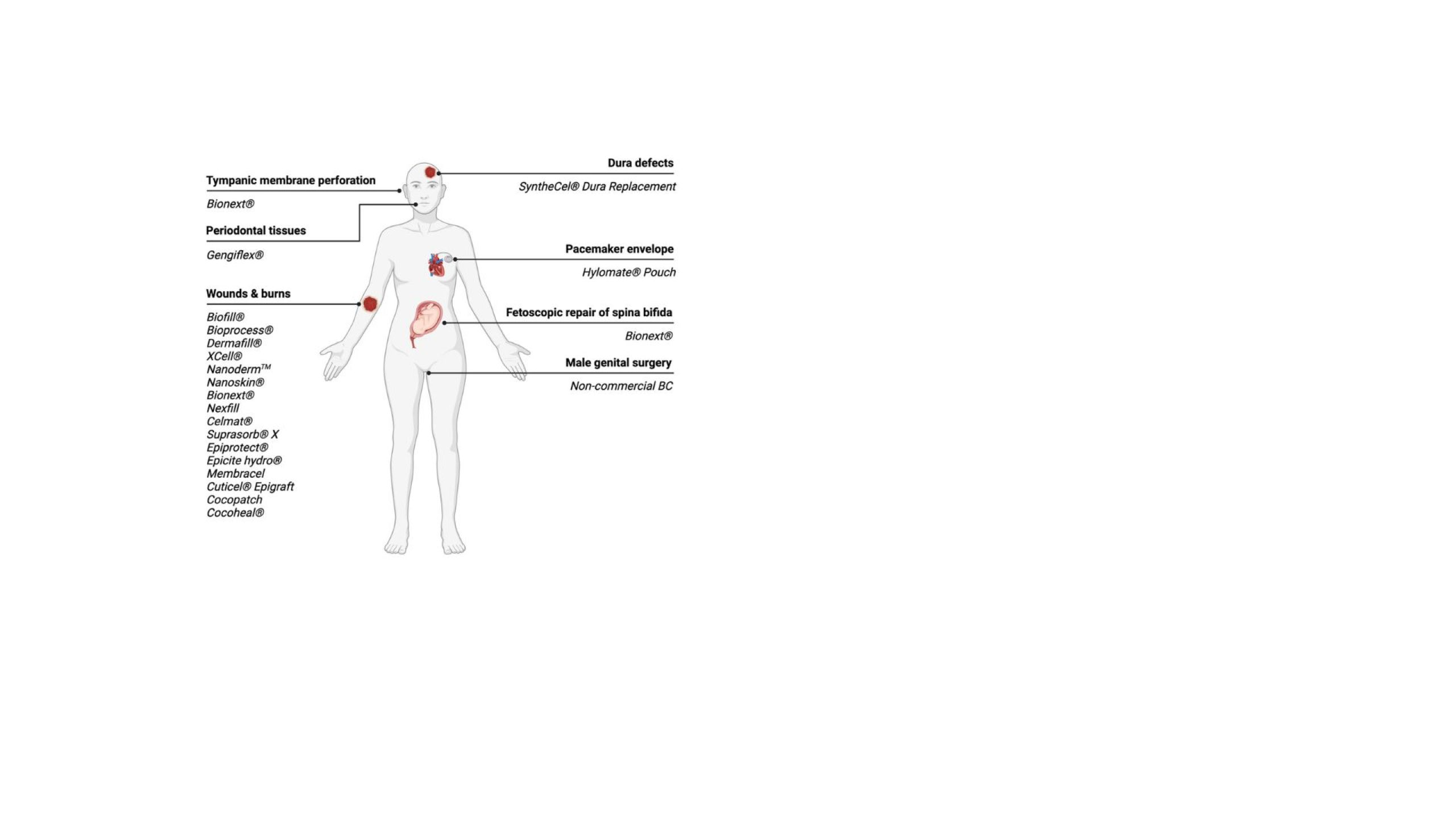 New paper: Review of clinical studies on bacterial cellulose